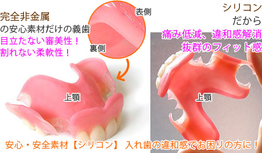 裏側の歯肉にあたる部分にシリコンを配した部分入れ歯